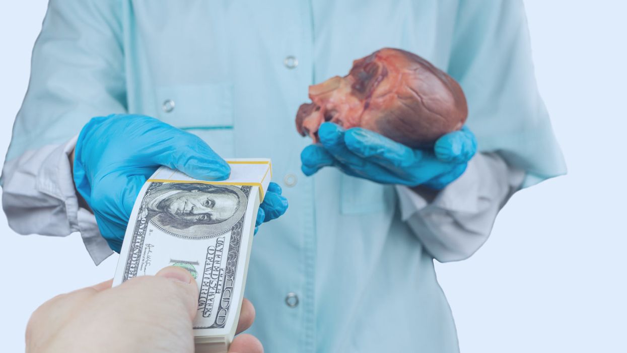 Should Organ Donors Be Paid?