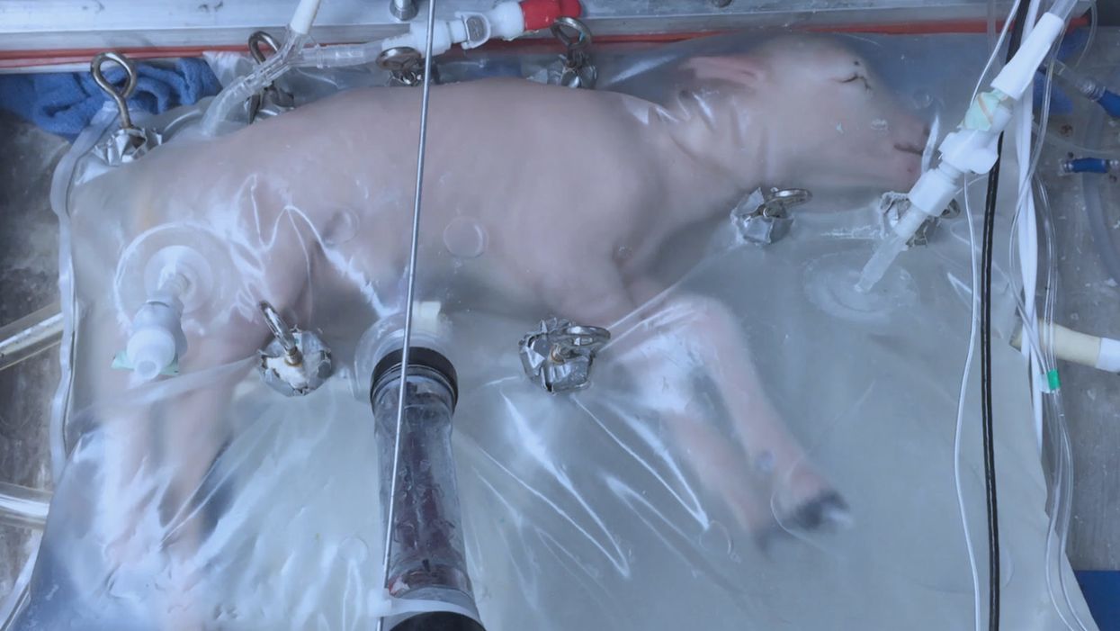 Why Don’t We Have Artificial Wombs for Premature Infants?