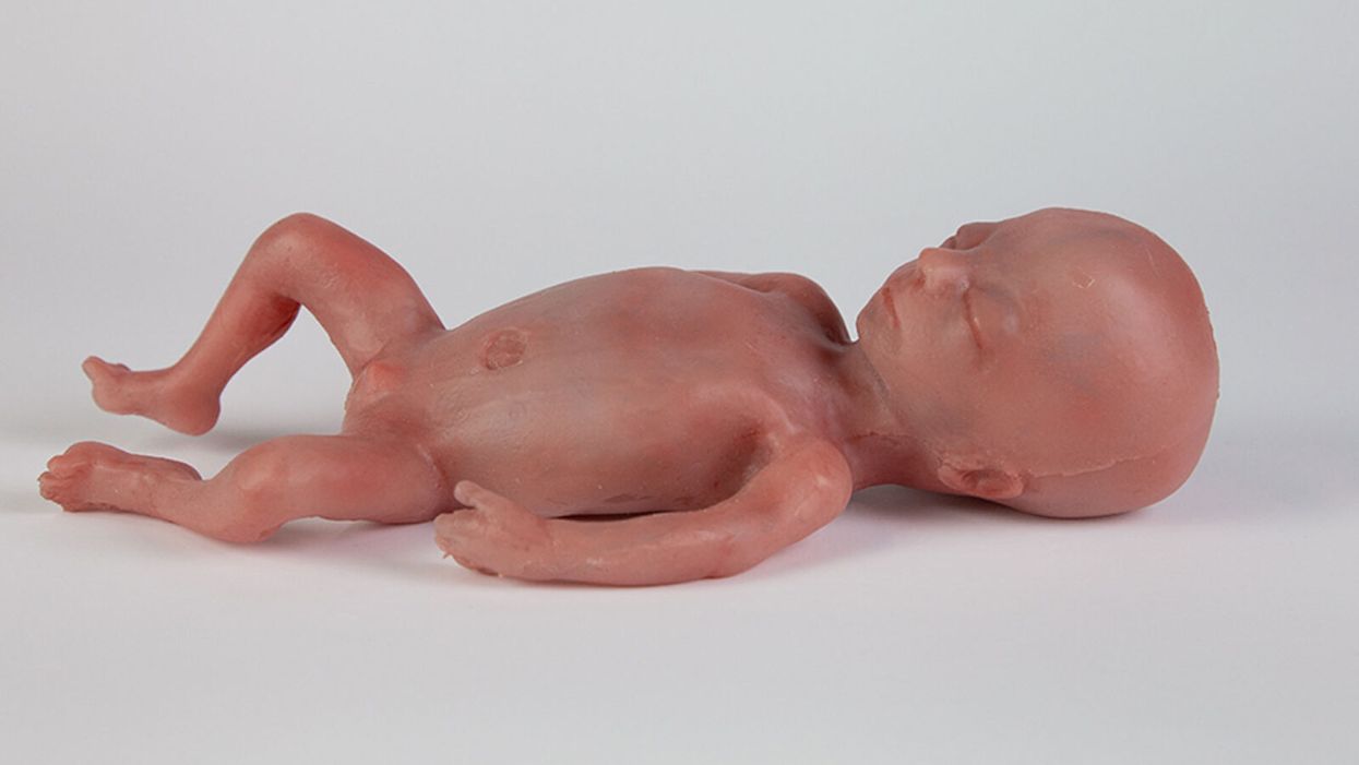 Artificial Wombs Are Getting Closer to Reality for Premature Babies