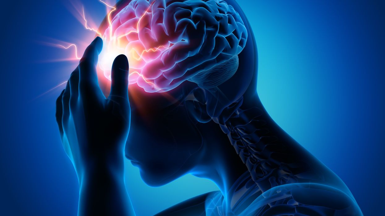 New device can diagnose concussions using AI