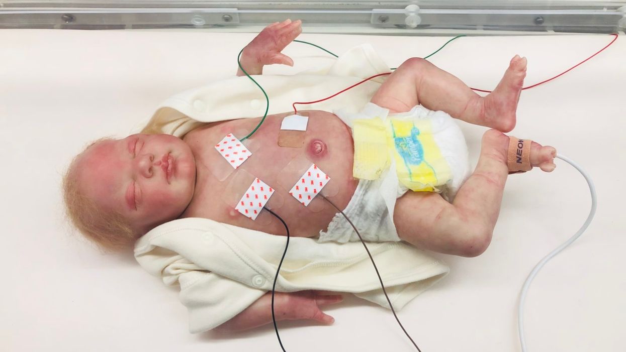 The Sickest Babies Are Covered in Wires. New Tech Is Changing That.