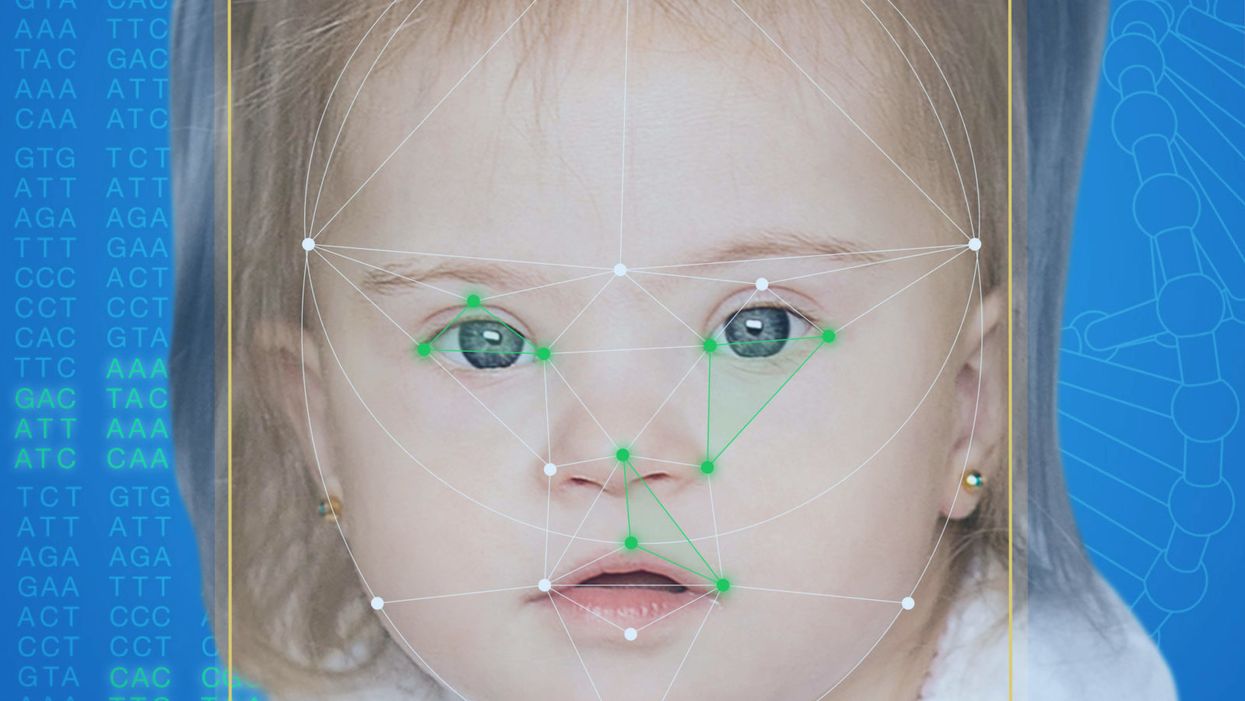 This App Helps Diagnose Rare Genetic Disorders from a Picture