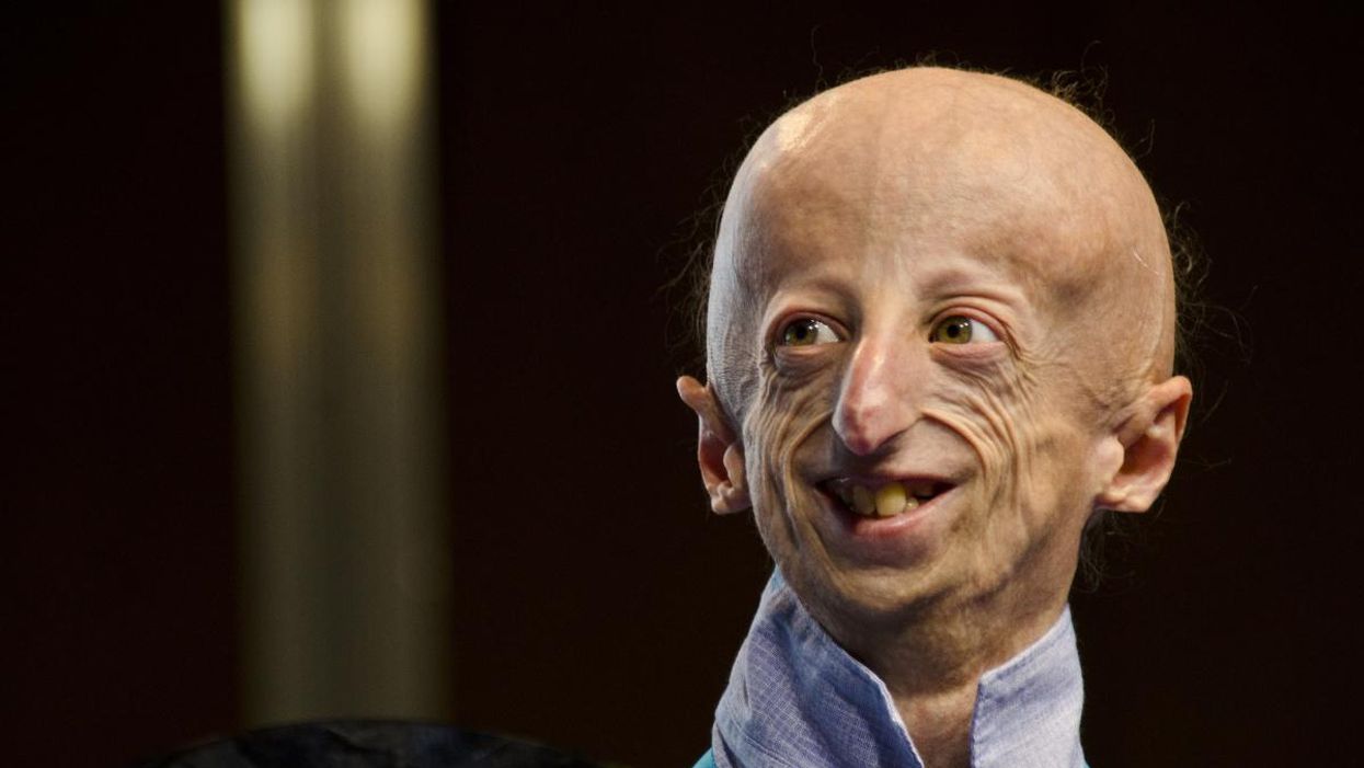 For Kids with Progeria, New Therapies May Offer Revolutionary Hope for a Longer Life