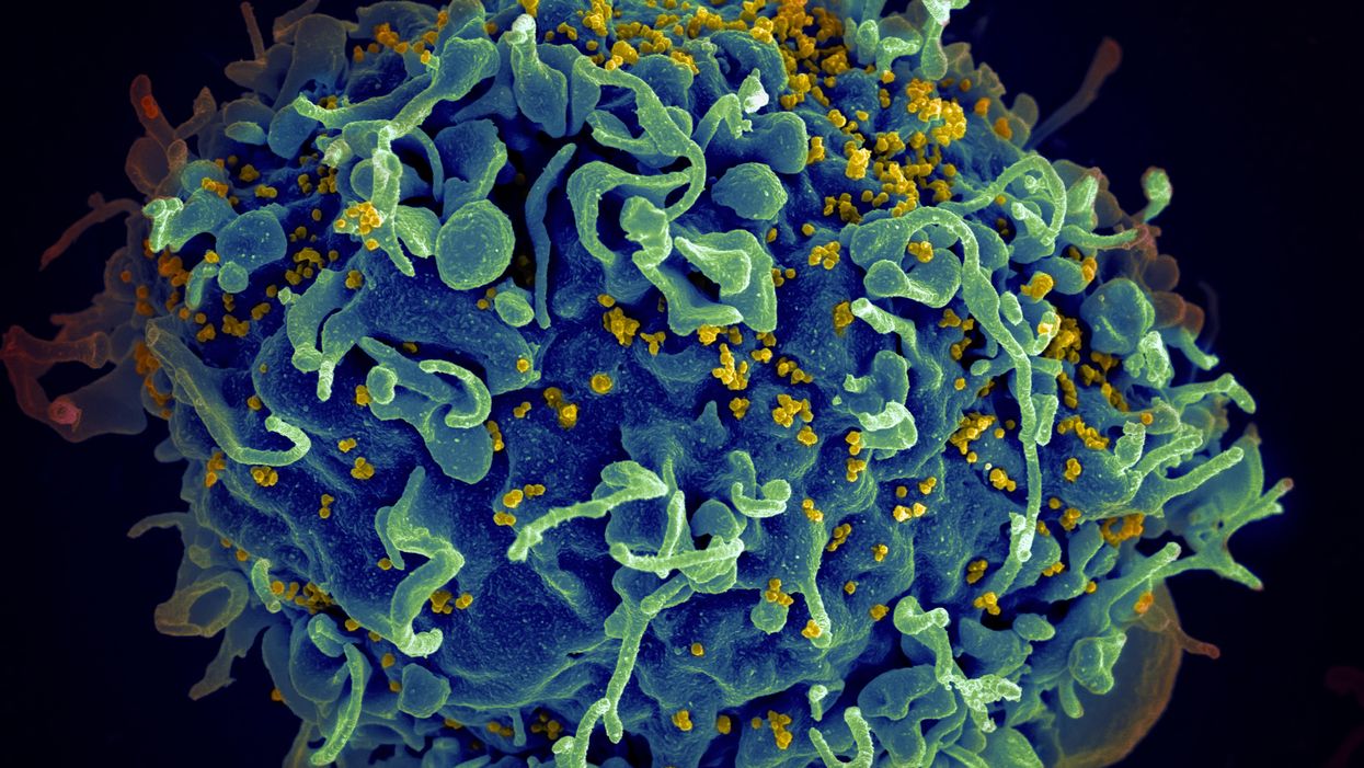 Is a Successful HIV Vaccine Finally on the Horizon?